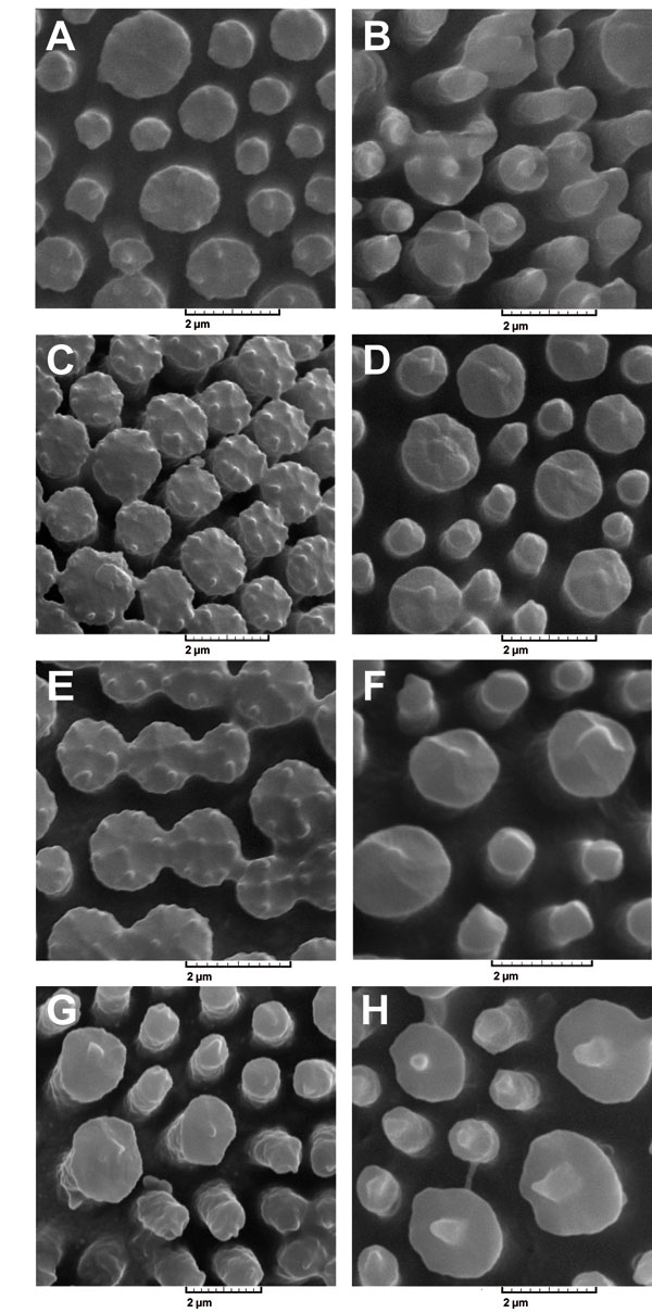 Electronic micrographs of pollen in studied subspecies of Linum